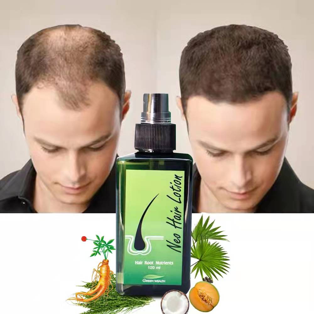 Paradise Made in Thailand Original New Hair Lotion Green Wealth Bangkok Herbs Treatment Regrowth Anti Loss Shampoo 120ml