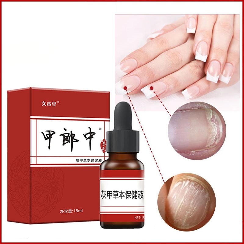 3pcs Nail Fungal Treatment Feet Care Essence Nail Whitening Toe Nail Fungus Removal Gel Anti Infection Paronychia Video