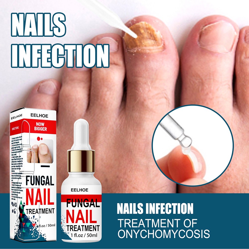 50ml Nail Repair Extract Anti Fungal Nail Treatment Remove Mycosis Nourishing Brighten Hand Foot Toes Nail Care