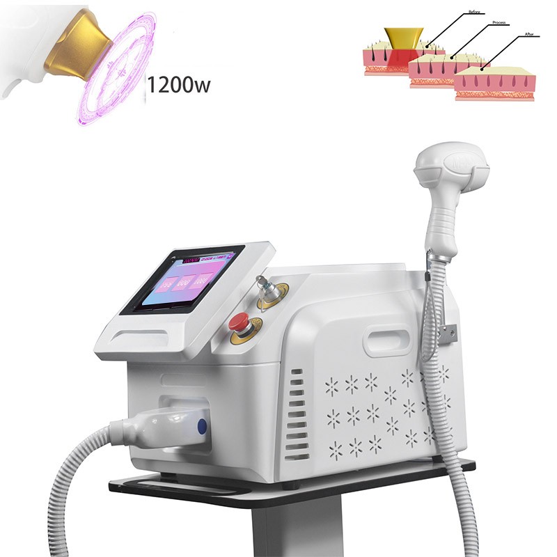 Lumenis lightsher-laser hair removal device, portable, 808nm, diode, high power