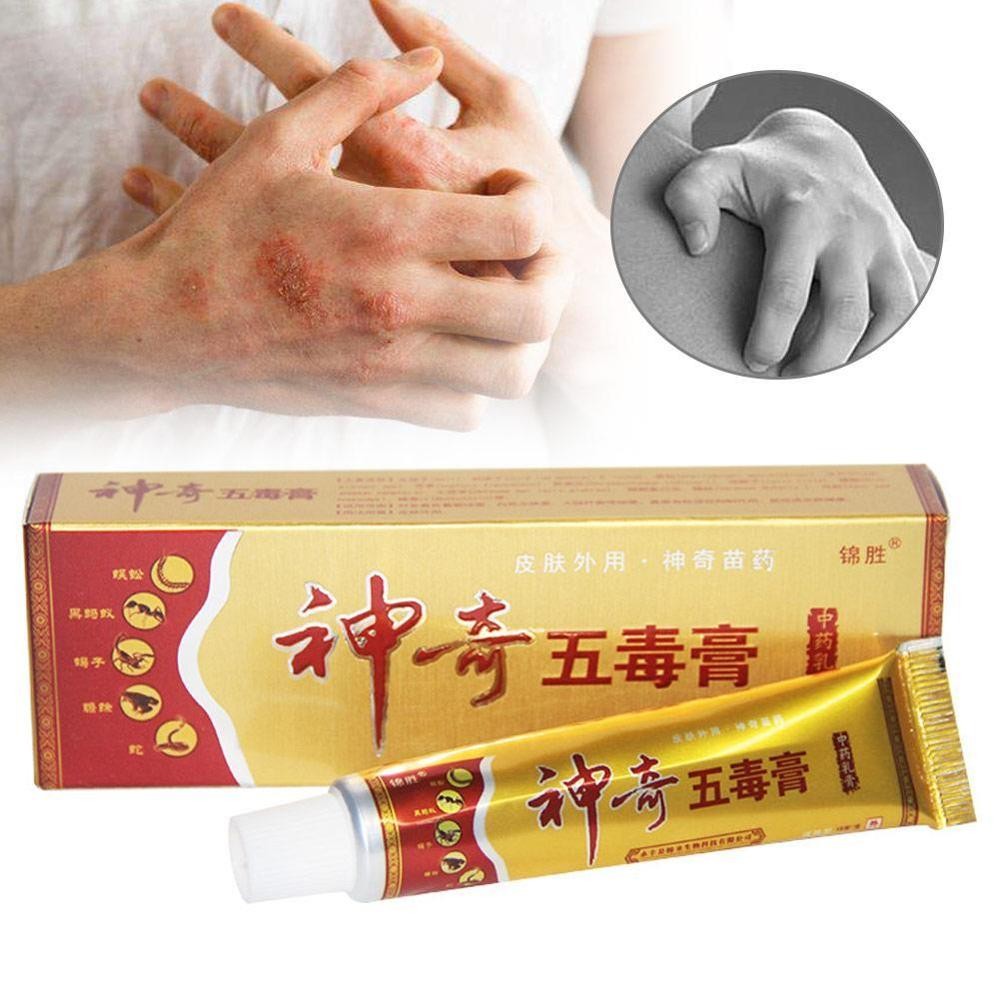 YIGANERJING Useful Psoriasis Cream Psoriasis Ointment Eczematoid Dermatitis Ointment Moisturizing Skin Cream