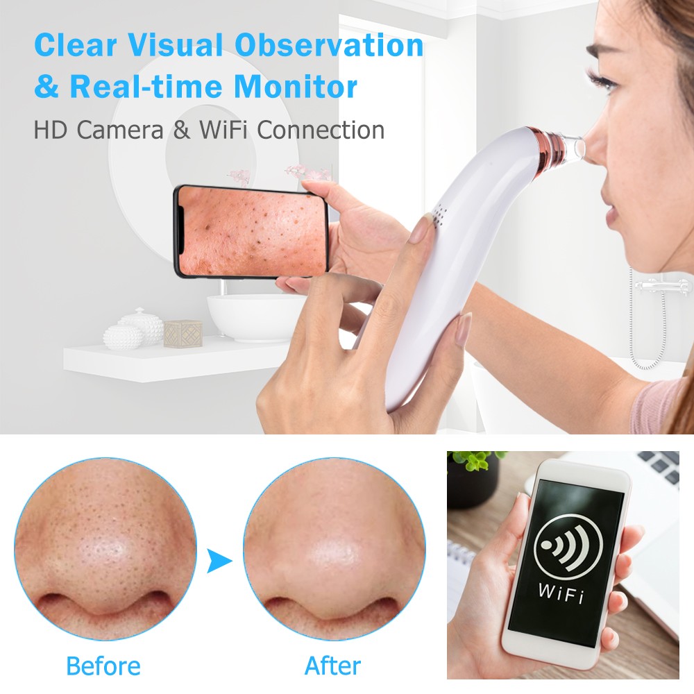 Visible Blackhead Remover Wireless Camera Monitor Suction USB Rechargeable Facial Pore Cleaner Comedone Anti Acne Pimple WiFi