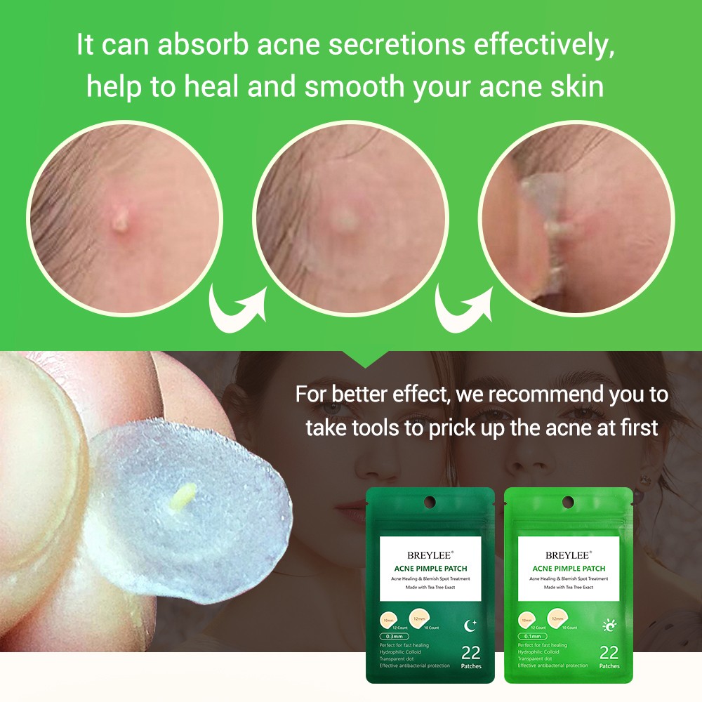 BREYLEE Acne Pimple Patch Stickers Acne Treatment Pimple Remover Tool Spot Blemish Face Mask Skin Care Waterproof 22 Patches