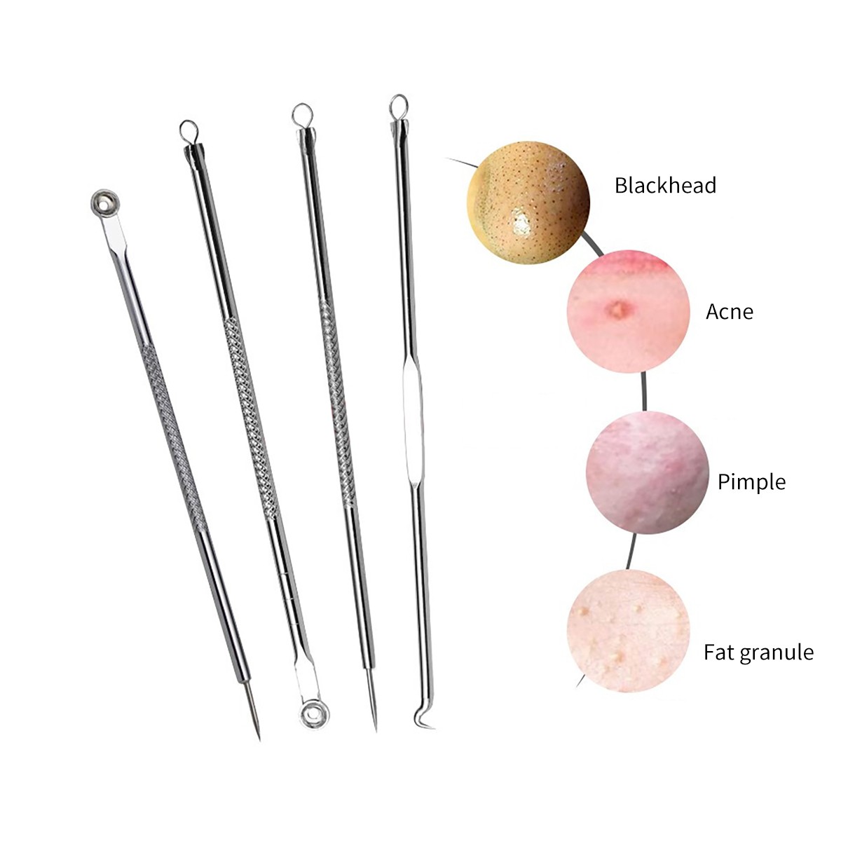 4pcs Stainless Steel Acne Removal Needles Pimple Blackhead Remover Tools Spatula Facial Skin Care Tools Needles Facial Pore Cleaner