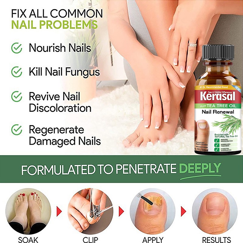 Fungal Nail Treatment Essential Oil Whitening Hand And Foot Toe Nail Fungus Remove Infection Feet Care Polish Nail Gel 50ml