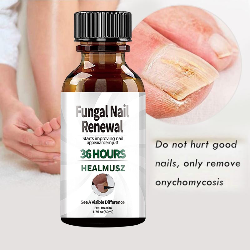 Fungal Nail Treatment Serum Onychomycosis Paronychia Anti-Fungal Nail Infection Herbal Toe Fungus Foot Repair Essence Care 50ml