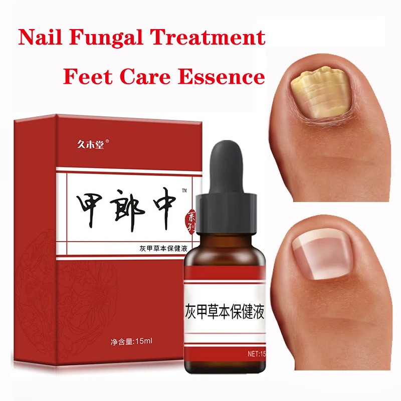 3pcs Nail Fungal Treatment Feet Care Essence Nail Whitening Toe Nail Fungus Removal Gel Anti Infection Paronychia Video