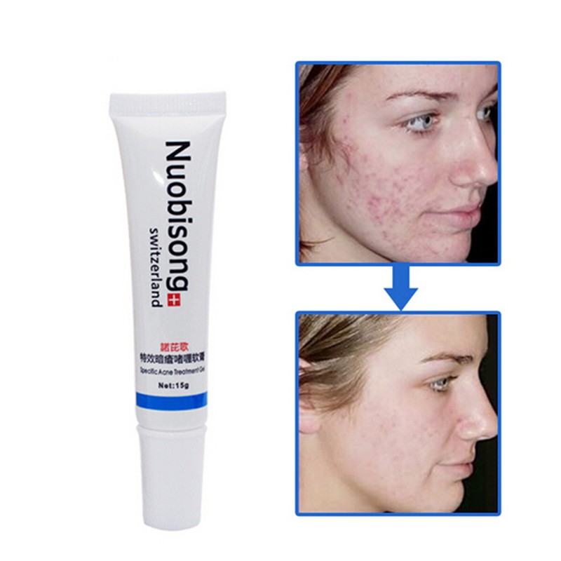 Nuobisong Face Skin Care Treatment Facial Pimples Scar Stretch Marks Removal Acne Treatment Whitening Moisturizing Cream