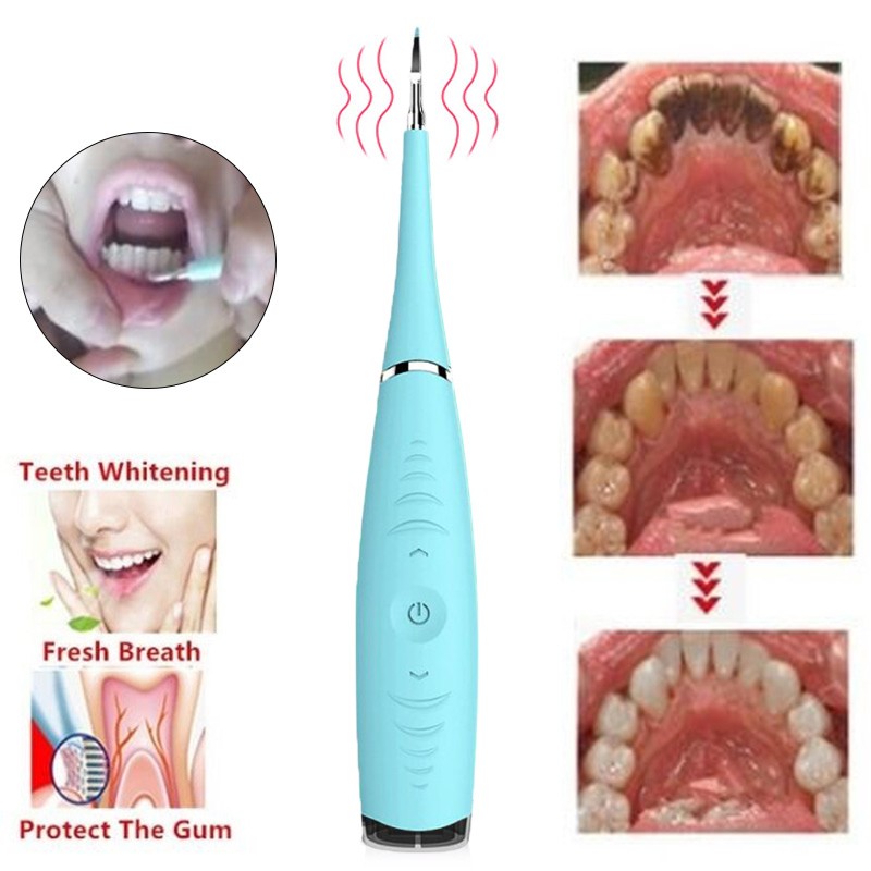 USB Charging Vibration Sonic Dental Scaler Teeth Calculus Teeth Stain Remover Tartar Cleaning Tool Teeth Whitening Dropshipping