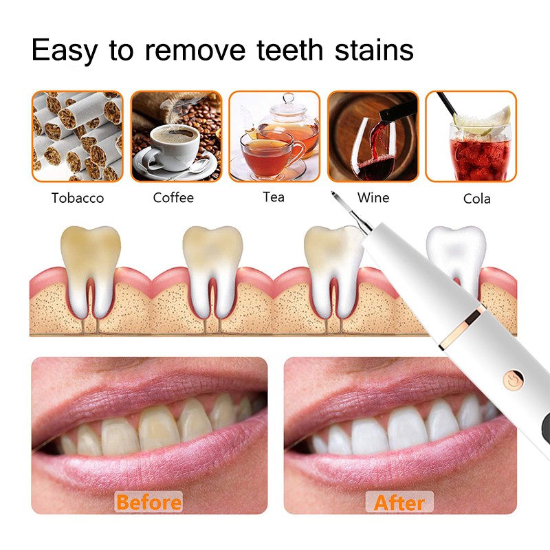 Plaque Stains Removal Cleaner Teeth Whitening Portable With LED Electric Sonic Dental Calculus Dental Scaler Oral Tartar Remover