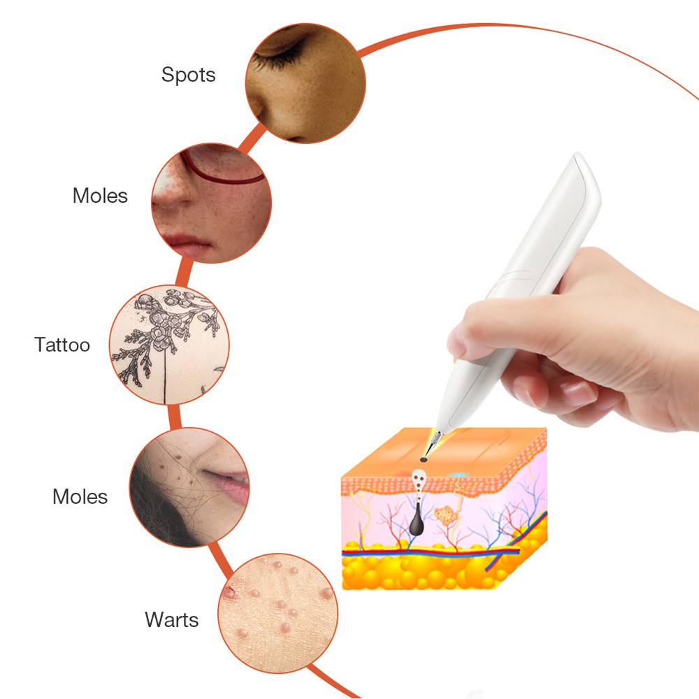 العناية بالبشرة الليزر الخلد الوشم إزالة النمش القلم الاجتياح إزالة Wart بقعة داكنة مزيل USB قلم بلازما نقطة تقليل جهاز تجميل