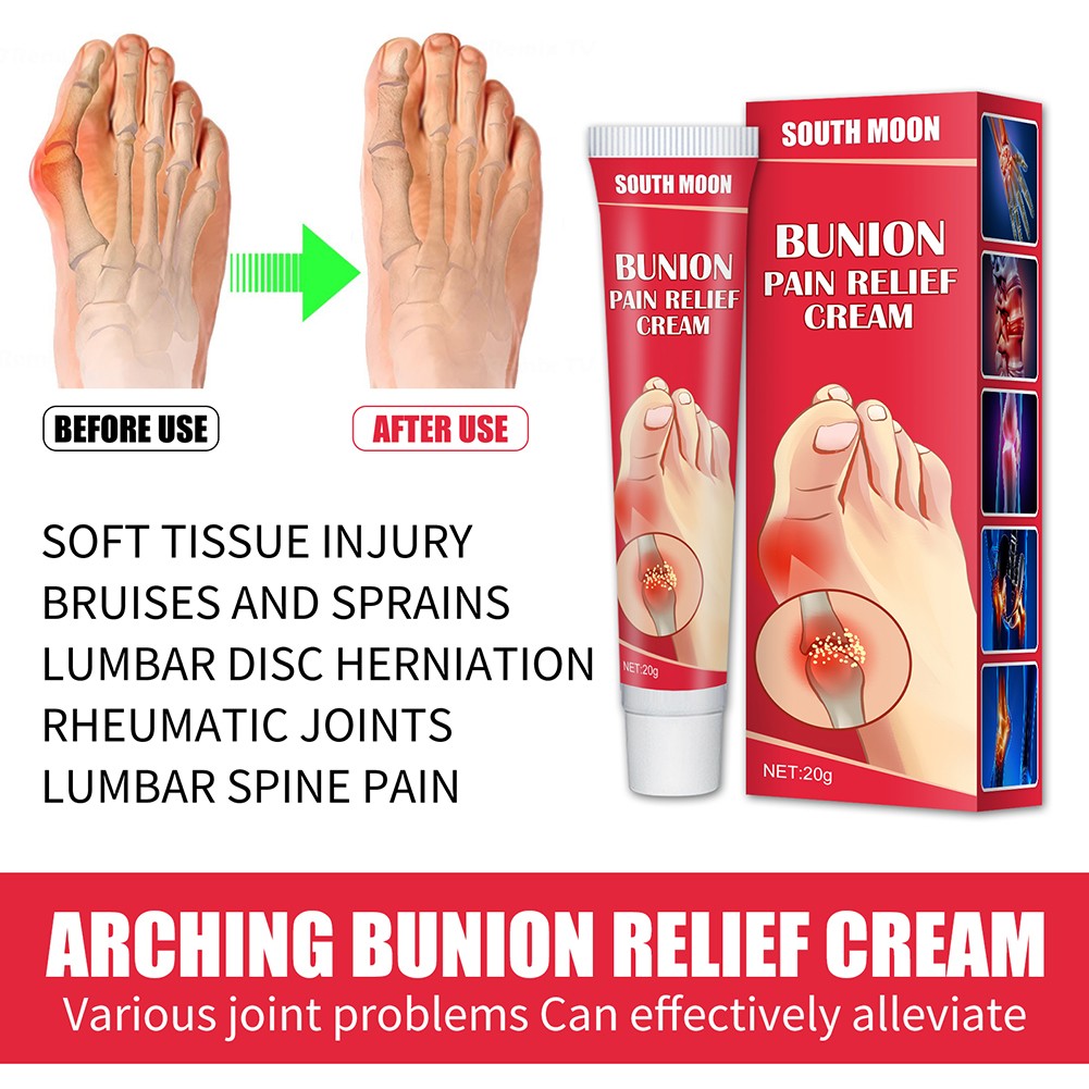 20g Arch Bunion Relief Cream Joint Toe Pain Relief Stiffness Treatment Knee Lower Back Arthritis Cream