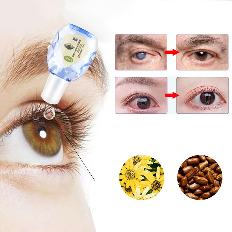 12ml Cool Eyes Drops Cataract Eye Treatment Cleanse Toxins Remove Eyeball Fatigue Relieves Discomfort Eye Health Care Drops