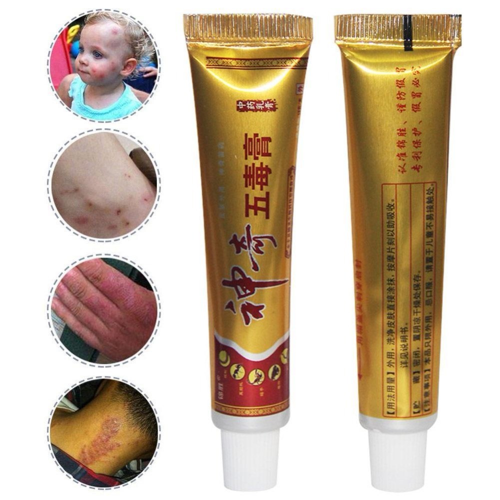 YIGANERJING Useful Psoriasis Cream (without retail box)