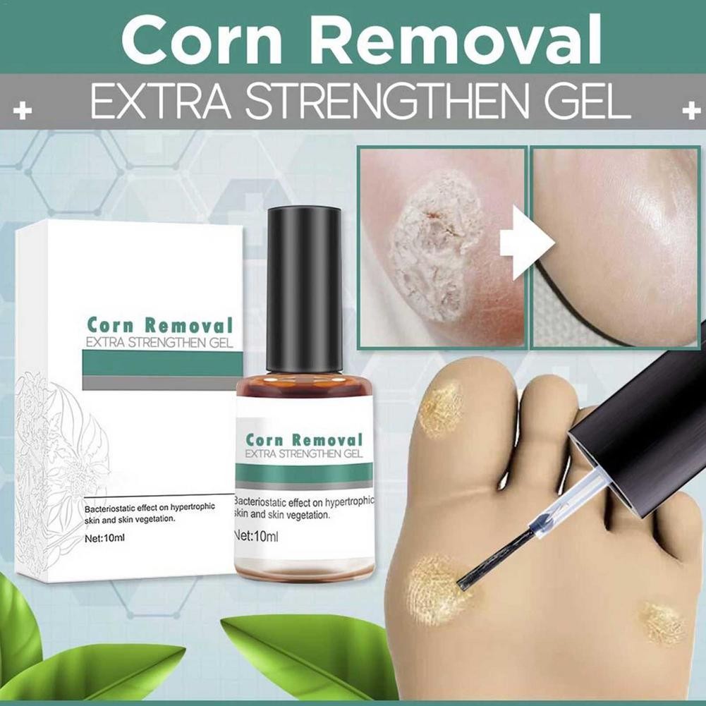 Wart Removal Extra Enhancement Gel Foot Care Health Care Liquid Smoothing Foot Essence Skin Painless Removal of Corns Treatment