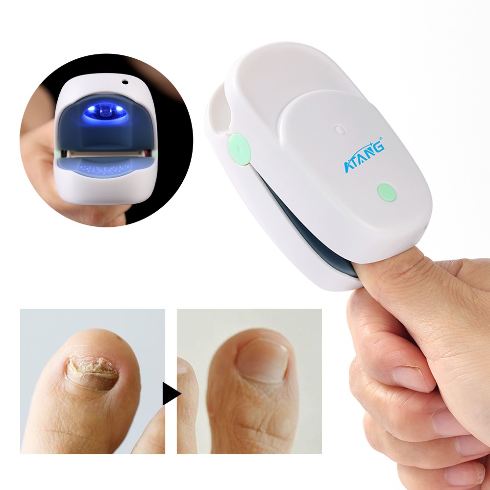 Fungal Nail Treatment Ingrown Toenails Treatment Anti-infection Paronychia Onychomycosis Treatment Infrared Light Therapy