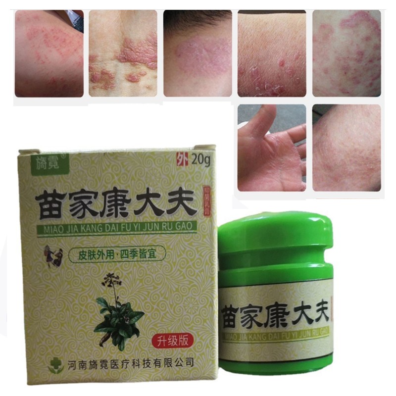 Eczema Psoriasis Antibacterial Cream Dermatitis Eczematoid Dermatitis Body Care Ointment from Psoriasis kangdaifu