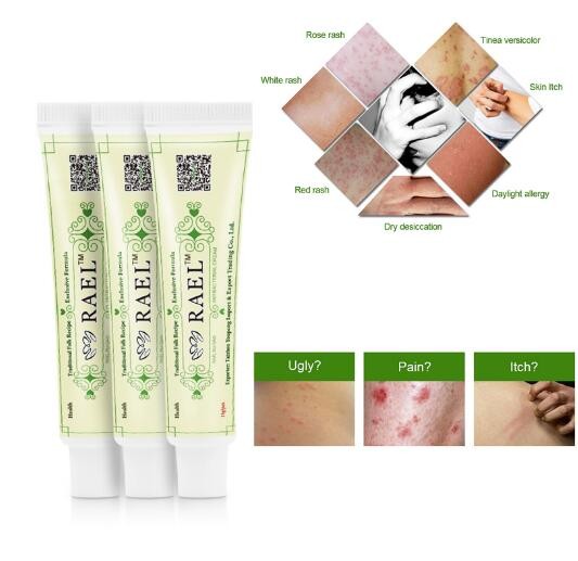 Zudaifu 1pc YIGANERJING 100% Original Powerful Professional Psoriasis Treatment Ointment Original Ingredient Medicine Safe