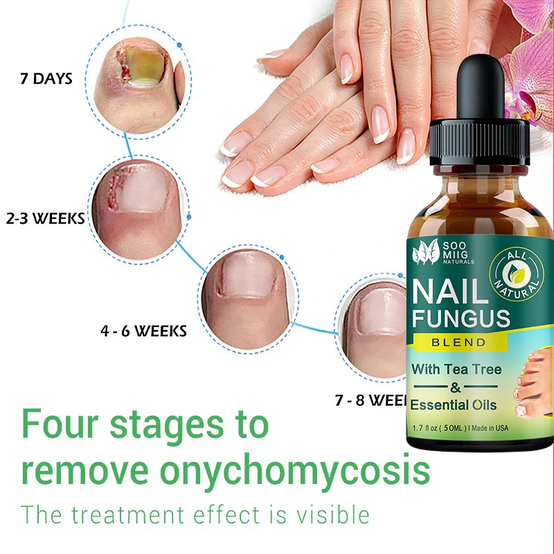 Nail Fungus Treatment Feet Care Nail Essence Repair Foot Toe Nail Fungus Removal Gel Anti Infection Paronychia Onychomycosis