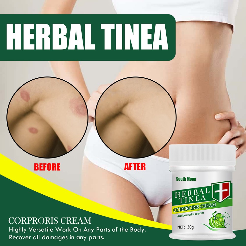 Effective Herbal Tinea Cream Fungal Anti Inflammation Ointment Infections Treatment Medicine Cream Health Care Tool