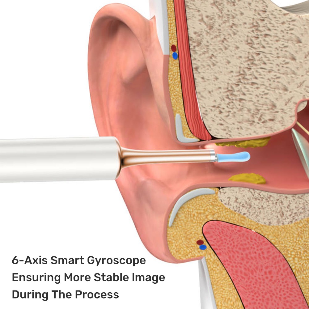 Bebird T15 Optical Ear Cleaner Endoscope Camera 2in1 Acne Wax Removal Cleaning Interaural Tool IP67 Waterproof Otoscope Mini Camera