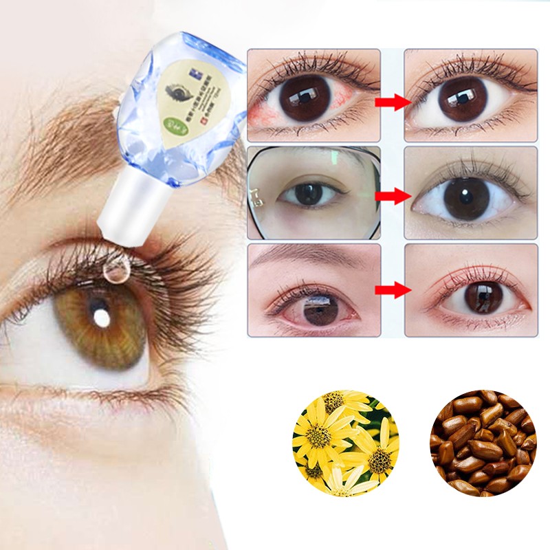 Eye drops for red infected eyes medical disinfection detoxification eyeball fatigue itching health care eye drop