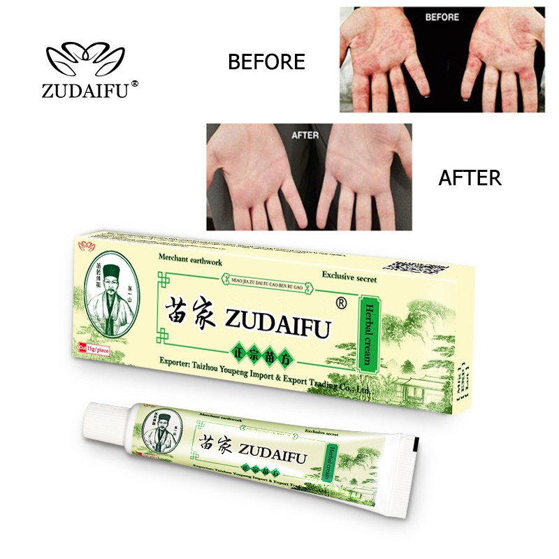 5pcs Zudaifu Original 15g Body Psoriasis Cream Skin Care Dropshipping Drop Shipping (With Box) 1/5pcs