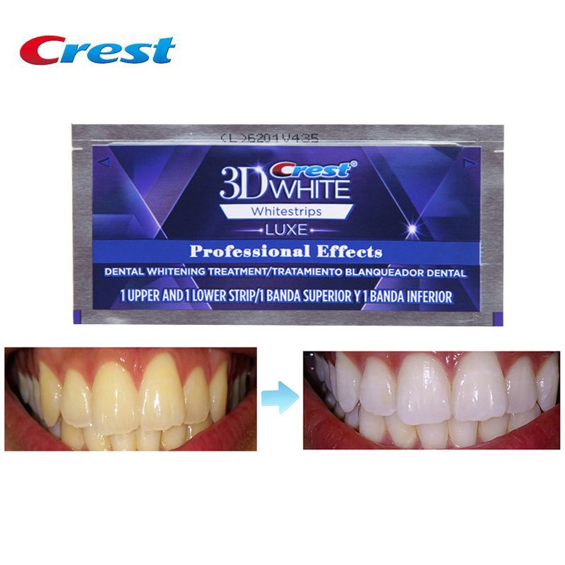 Crest 3D Teeth Whitening Kit Teeth Whitening Kit 12 Months Teeth Whitening Kit