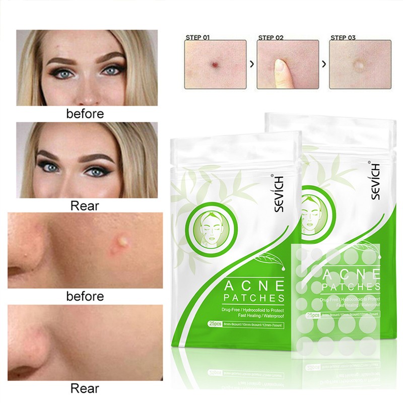 36pcs Hydrocolloid Acne Cosmetics Patch Set Acne Tag Remover Pimple Master Hydrocolloid Patch Face Skin Care TSLM1