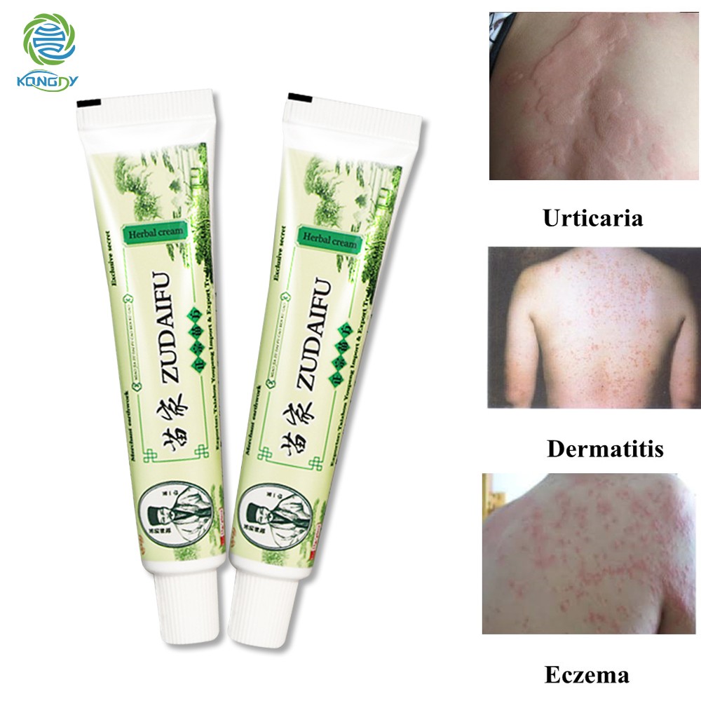 Hot Sale 10pcs Yiganerjing Zudaifu Psoriasis Body Cream