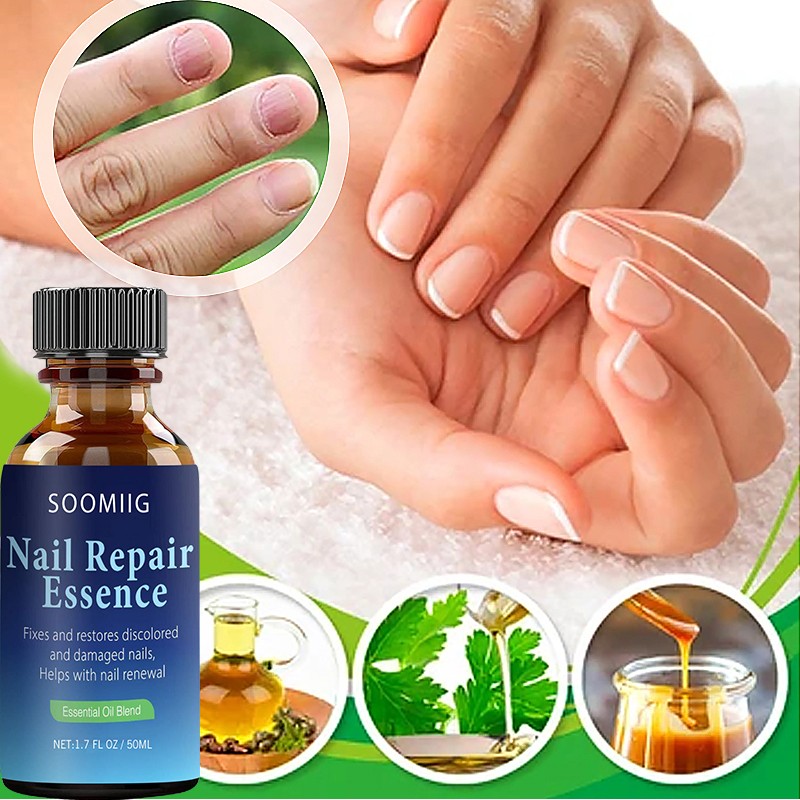 Nail Repair Serum Nail Fungal Treatment Serum Toenail Fungus Treatment Device Antifungal Toe Fungus Treatment Foot Repair Care