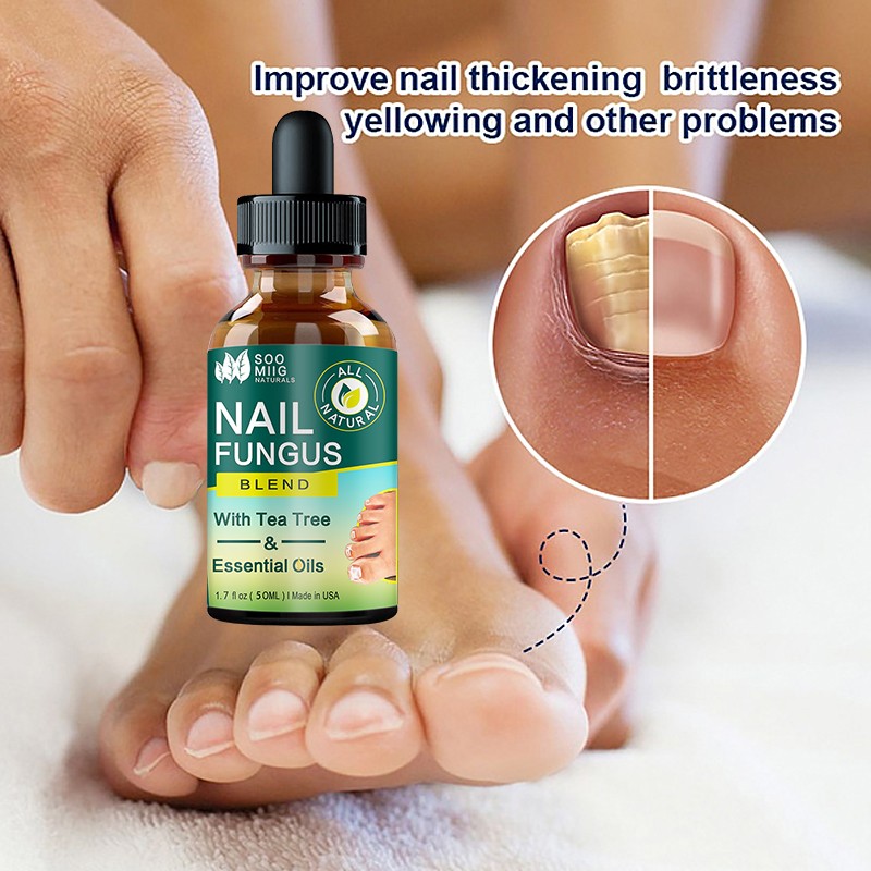 Nail Fungus Treatment Feet Care Nail Essence Repair Foot Toe Nail Fungus Removal Gel Anti Infection Paronychia Onychomycosis