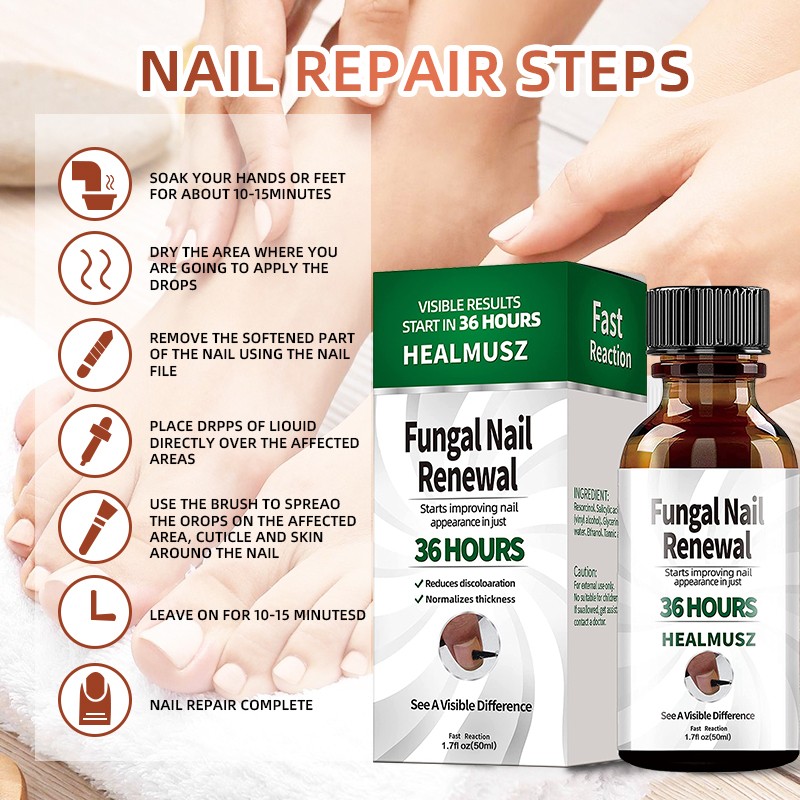 Fungal Nail Treatment Serum Onychomycosis Paronychia Anti-Fungal Nail Infection Herbal Toe Fungus Foot Repair Essence Care 50ml