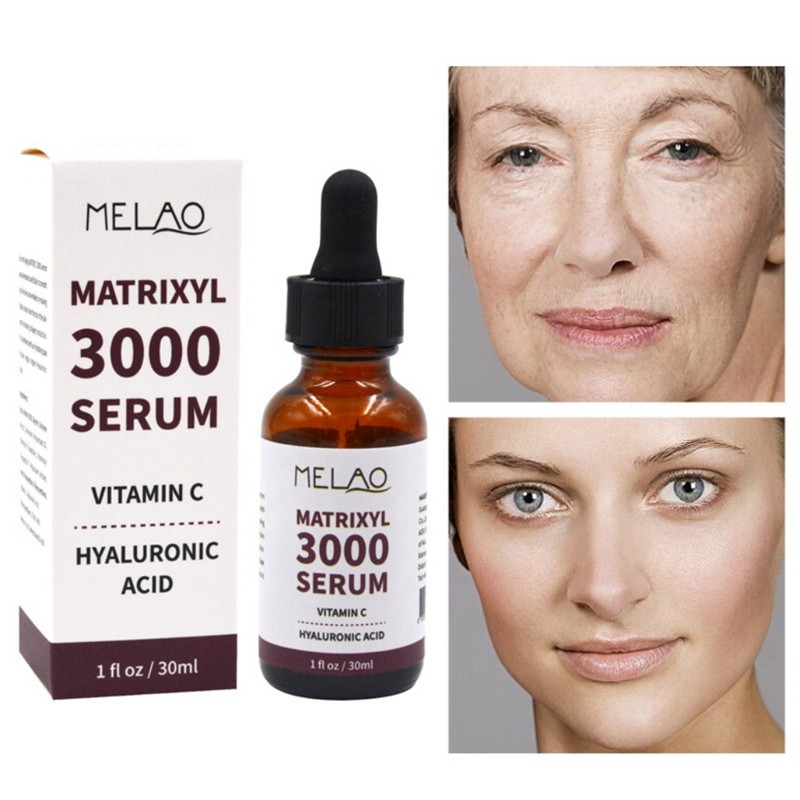 Matrixyl 3000 Vitamin C Serum Hyaluronic Acid Reduces Sun Spots Wrinkles Face Serum 30ml