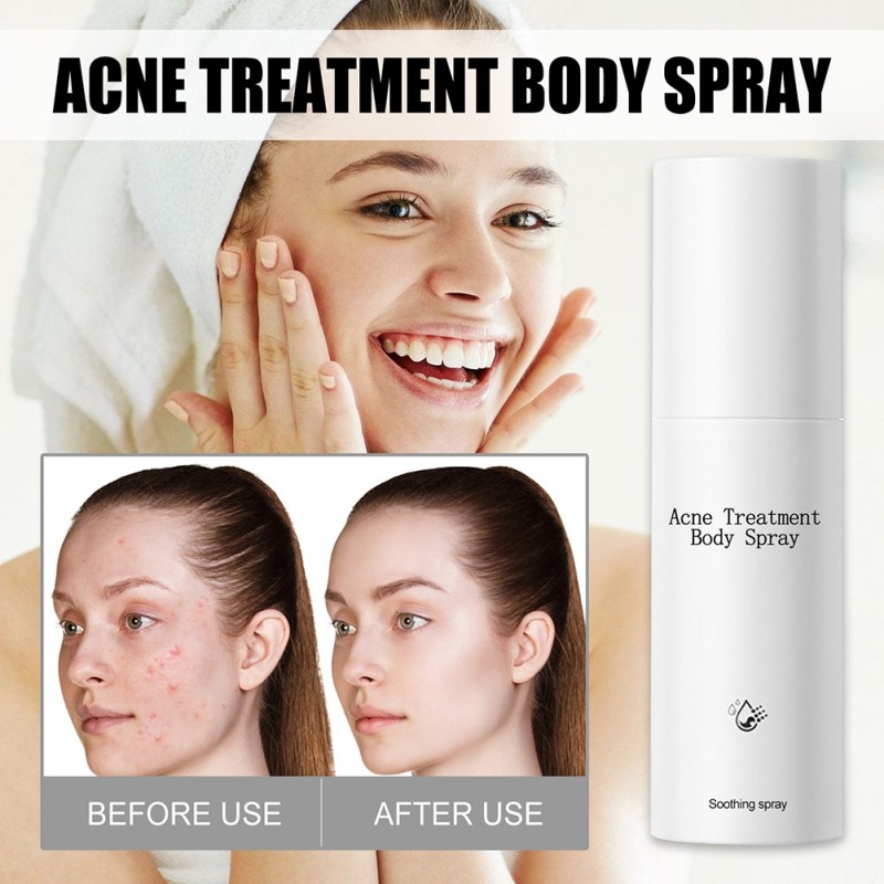 Acne Body Spray 100ml Body Chest Butt Back Acne External Use Multiple Daily Uses For All Skin Types Acne Treatment