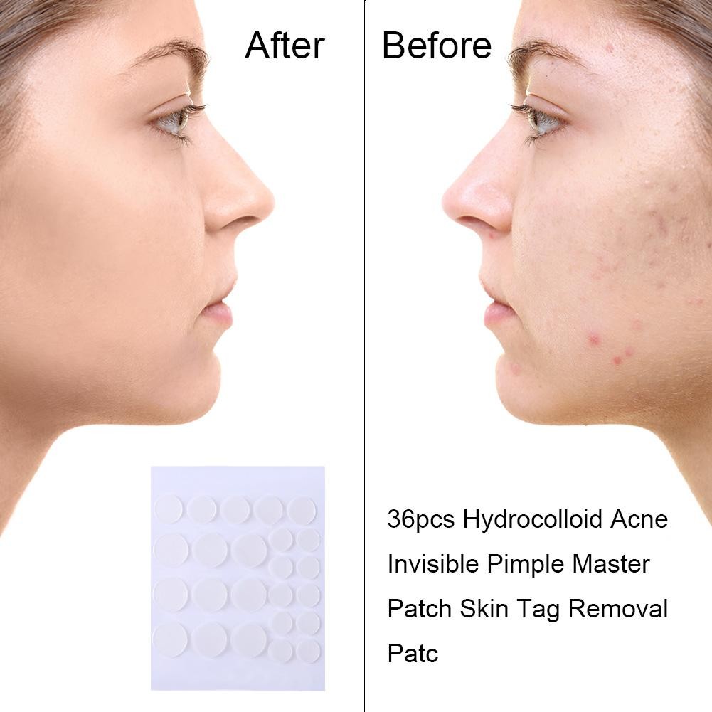 24/36pcs Invisible Hydrocolloid Acne Patch Pimple Blemish Removal Stickers Breathable Pimple Blemish Removal Sticker Face Care