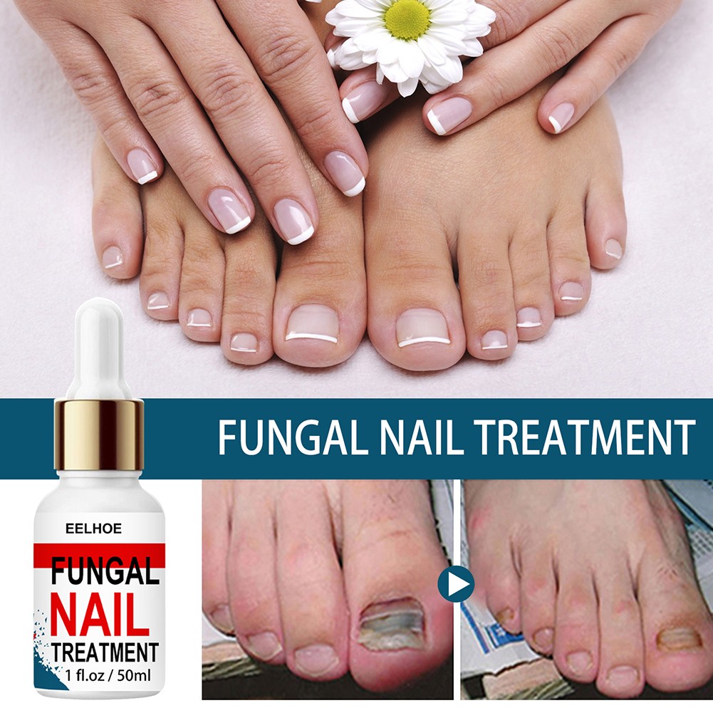 50ml Nail Repair Extract Anti Fungal Nail Treatment Remove Mycosis Nourishing Brighten Hand Foot Toes Nail Care