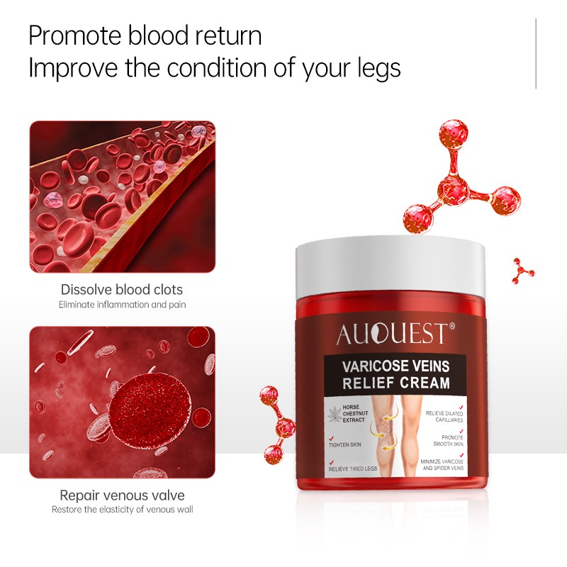 AUQUEST Varicose Veins Treatment Cream Relieve Fatigue Legs Dilatation Inflammation Felipe Vasculitis Spider Pain Relief Ointment Body Care 80g