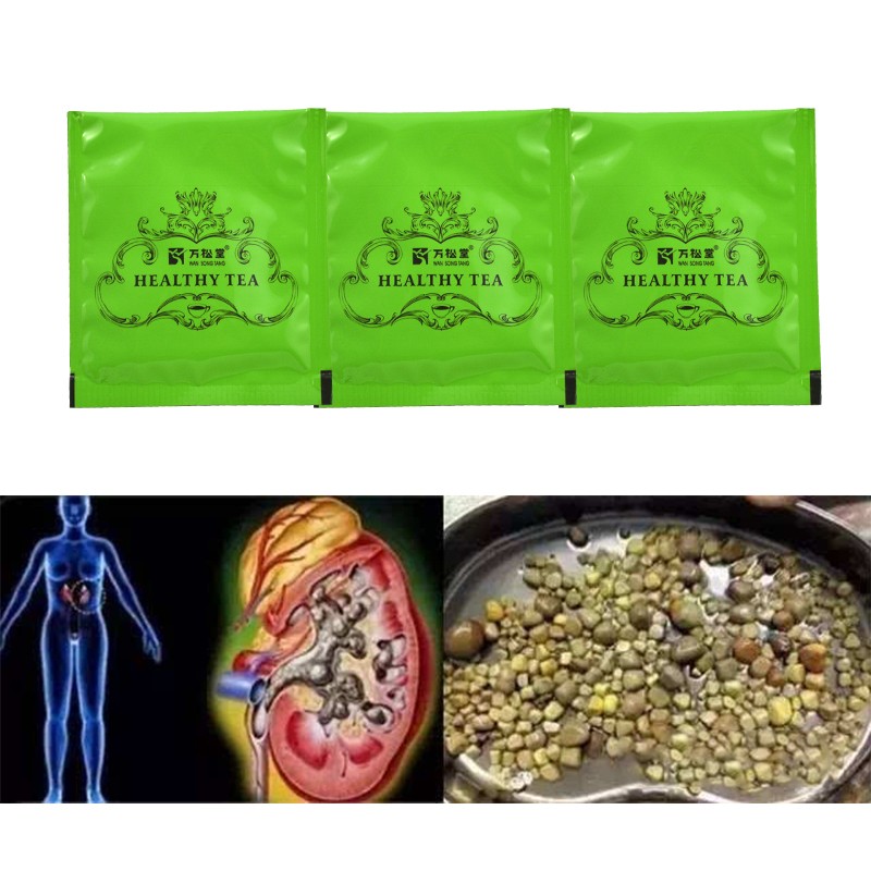 40pcs/2packs Kidney Stones Cleaning Drink Tea Chinese Medicine Care Kidney Treatment Toxin Excretion Kidney Cleaning Product