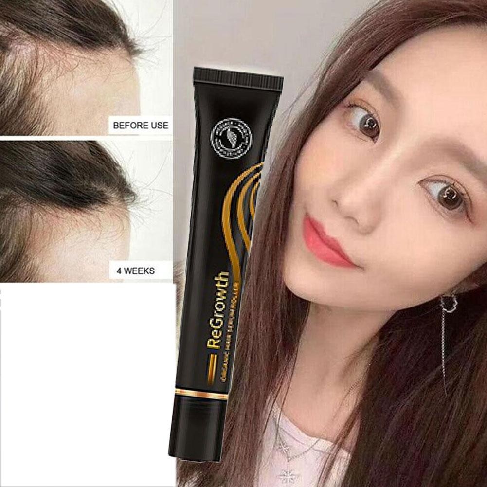 Roller Ball Massage Hair Care Styling Lotion Nourishing Essence Anti Hair Loss Relieve Hair Growth Essence All Hair Type