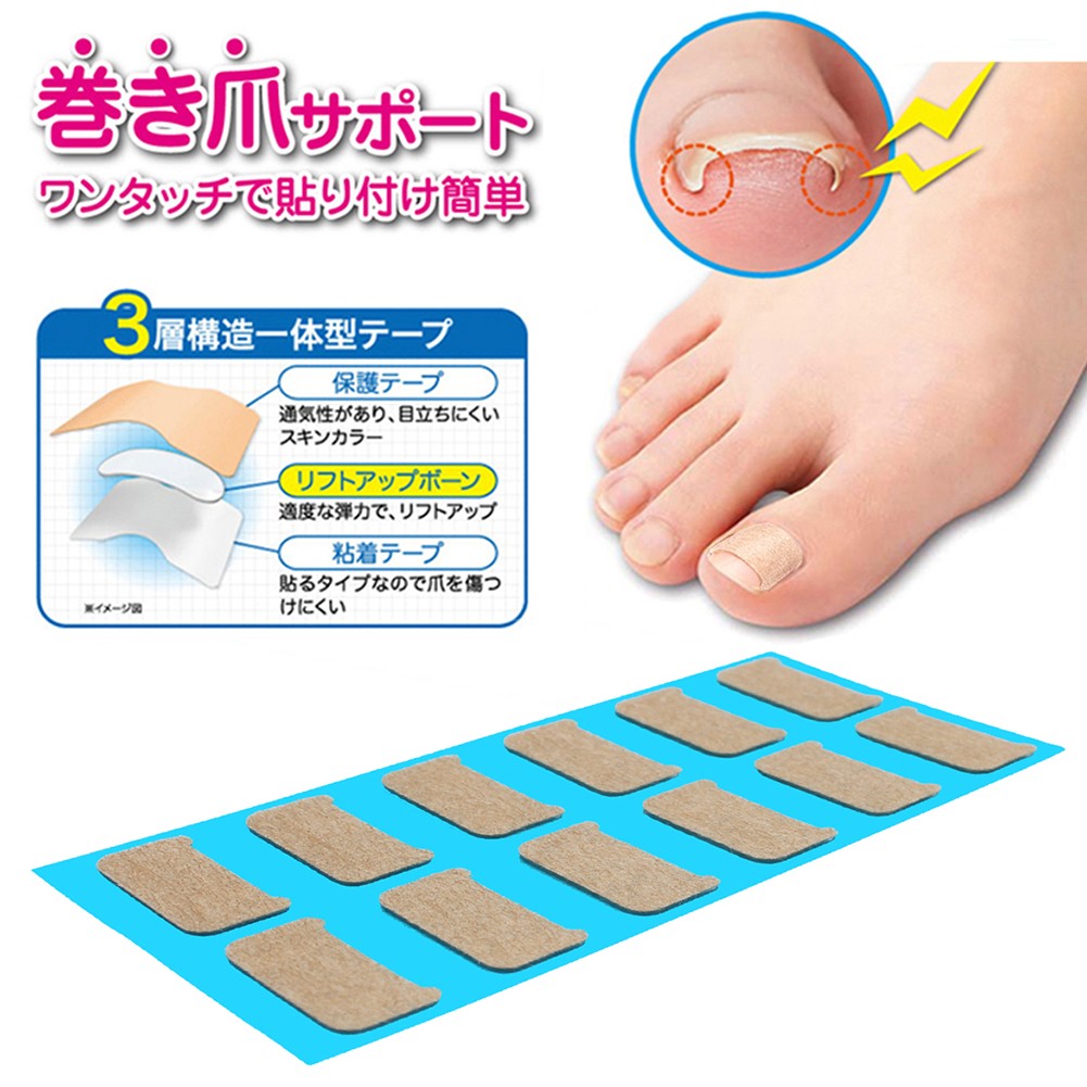 Paronychia Treatment Recovery Sticker Ingrown Toenail Correction Stickers Patches Treatment Fixer Foot Corrector Toe