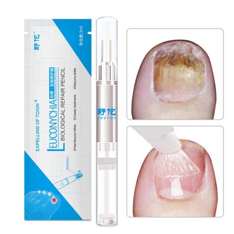 3ml Effective Nail Fungus Pen For Paronychia Infection Treatment Solution Gel Nail Treatment Essence Nutrients