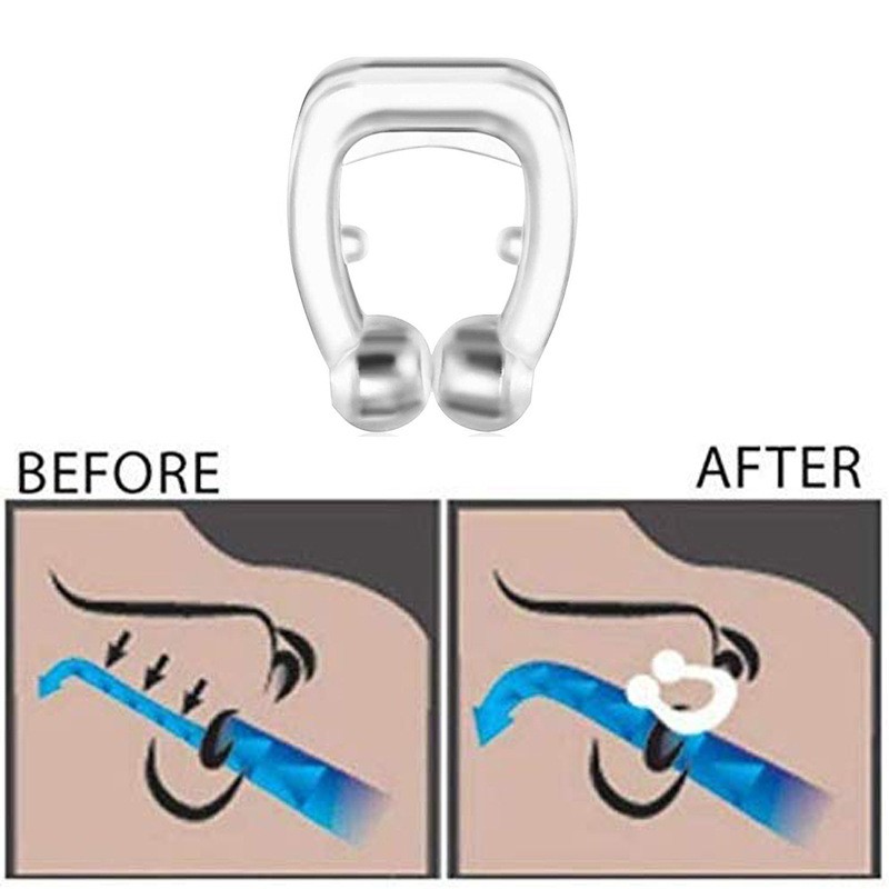 Anti Snoring Device Noseclip Stopper Snore Treatment Products Stop Clip Dilatador Nose Nose Ronflement Ronquidos Snurk Snurken