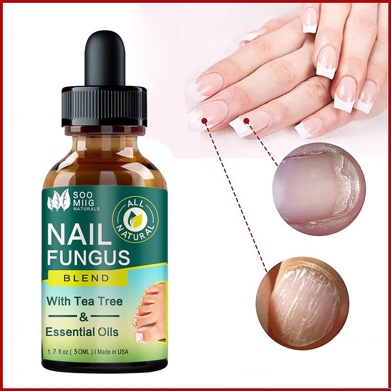 Nail Fungus Treatment Feet Care Nail Essence Repair Foot Toe Nail Fungus Removal Gel Anti Infection Paronychia Onychomycosis