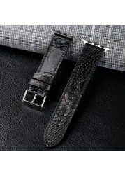 South African Ostrich Foot Leather Watchband Suitable For iwatch 44 42 40 4145mm Apple Watch Bracelet Handmade Genuine Leather