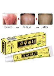 10pcs/lot Yiganerjing QICAOGANGMU Skin Psoriasis Cream + 5pcs Gift (without box)