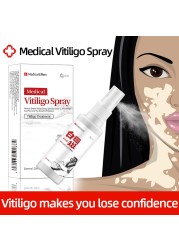 Chinese Medical Vitiligo Antibacterial Hand Spray White Spot Repair Liquid Foot Disease Leukoplakia Promote Melanin