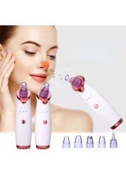 Face Blackhead Remover Electric Pore Cleaner Face Nose Cleaner Deep T Area Pore Acne Pimple Removal Vacuum Suction