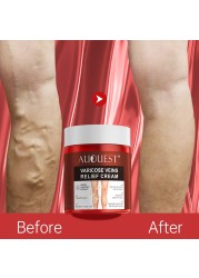 AUQUEST Varicose Veins Treatment Cream Relieve Fatigue Legs Dilatation Inflammation Felipe Vasculitis Spider Pain Relief Ointment Body Care 80g