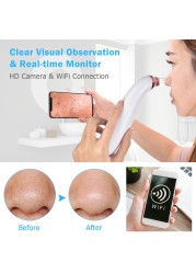 Visible Blackhead Remover Wireless Camera Monitor Suction USB Rechargeable Facial Pore Cleaner Comedone Anti Acne Pimple WiFi